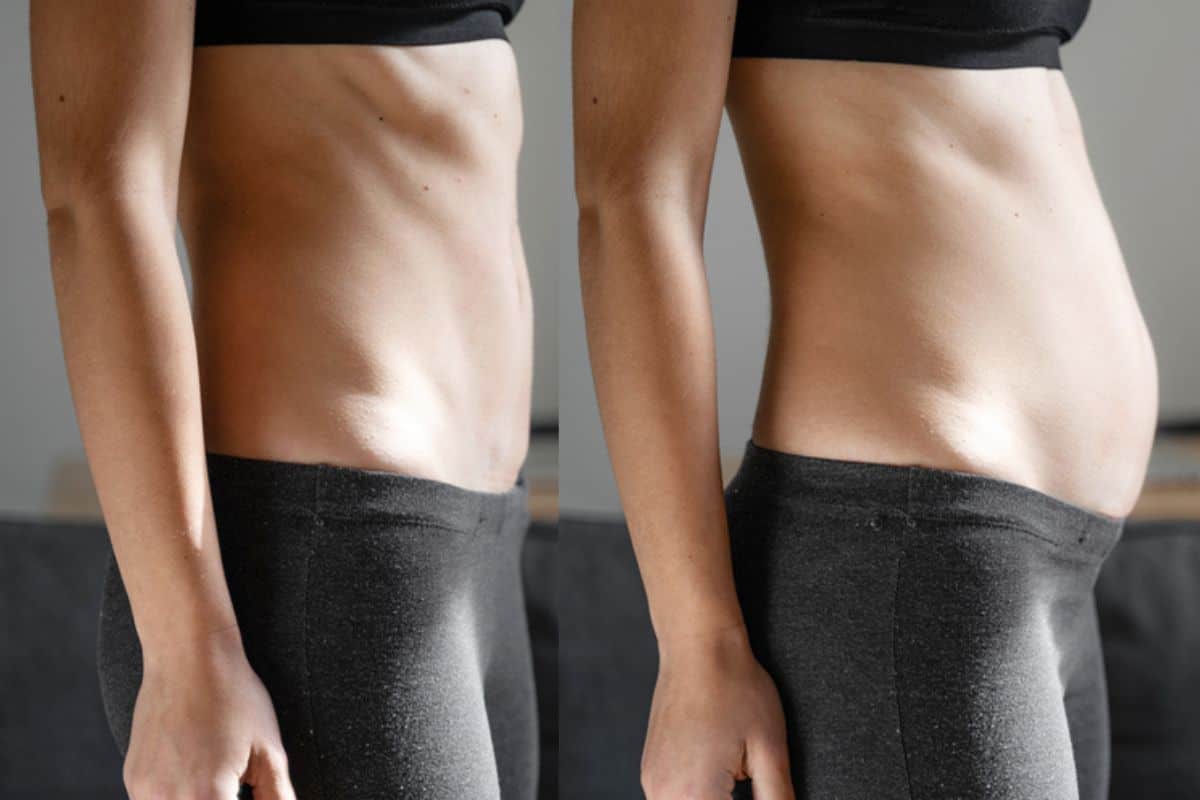 How long does diastasis recti take to improve Greater London (Enfield)?