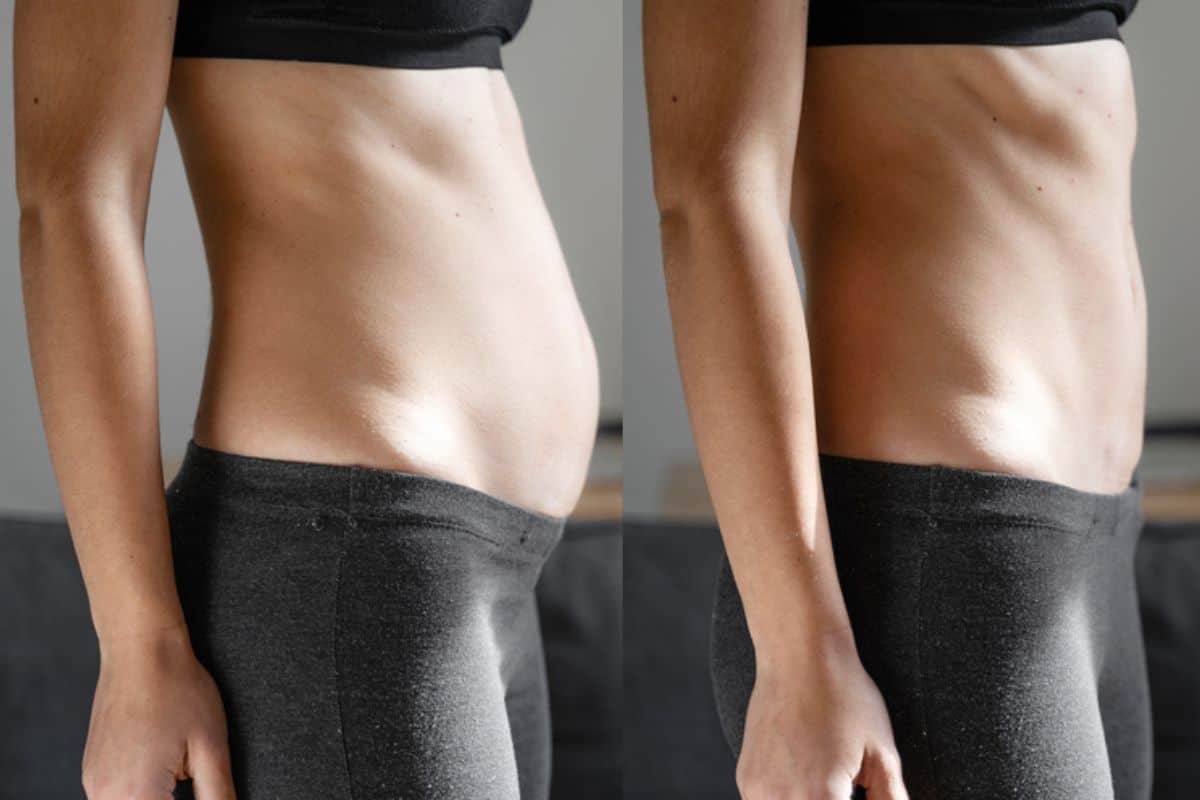 Post-Pregnancy: What Happens to Your Abdominal Muscles After Birth Greater London (Enfield)