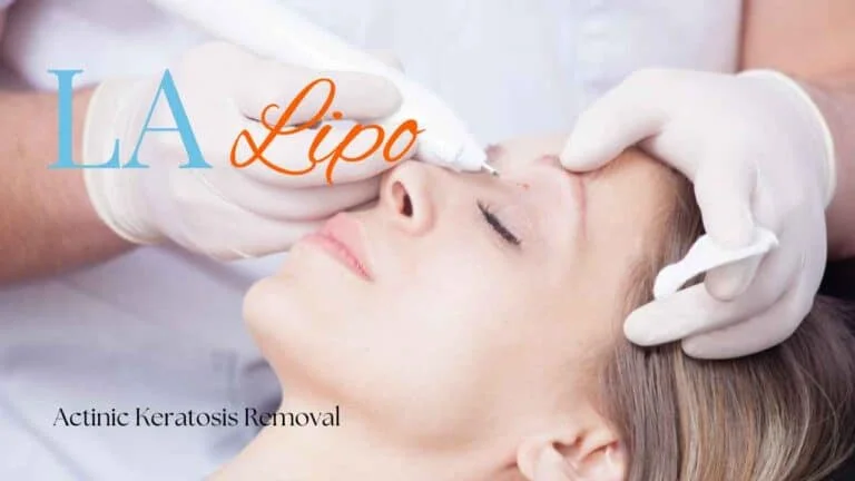 Woman receiving Actinic Keratosis Removal Treatment Greater London (Enfield)