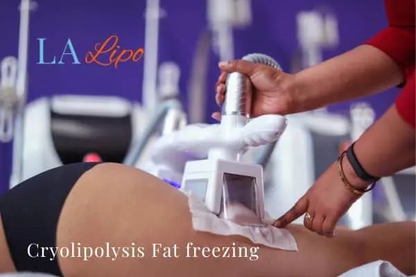 women getting fat freezing Greater London (Enfield)