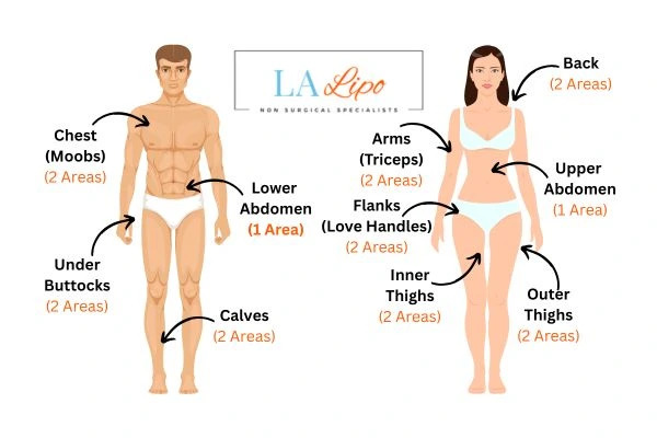 LA LIPO Cryolipolysis Areas Greater London (Enfield)