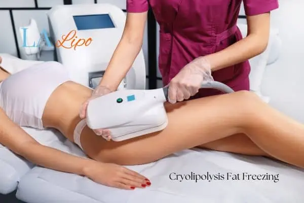 Woman receiving coolsculpting Greater London (Enfield) treatment on her thighs