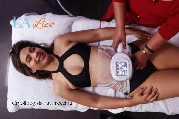 woman getting cryolipolysis Greater London (Enfield)