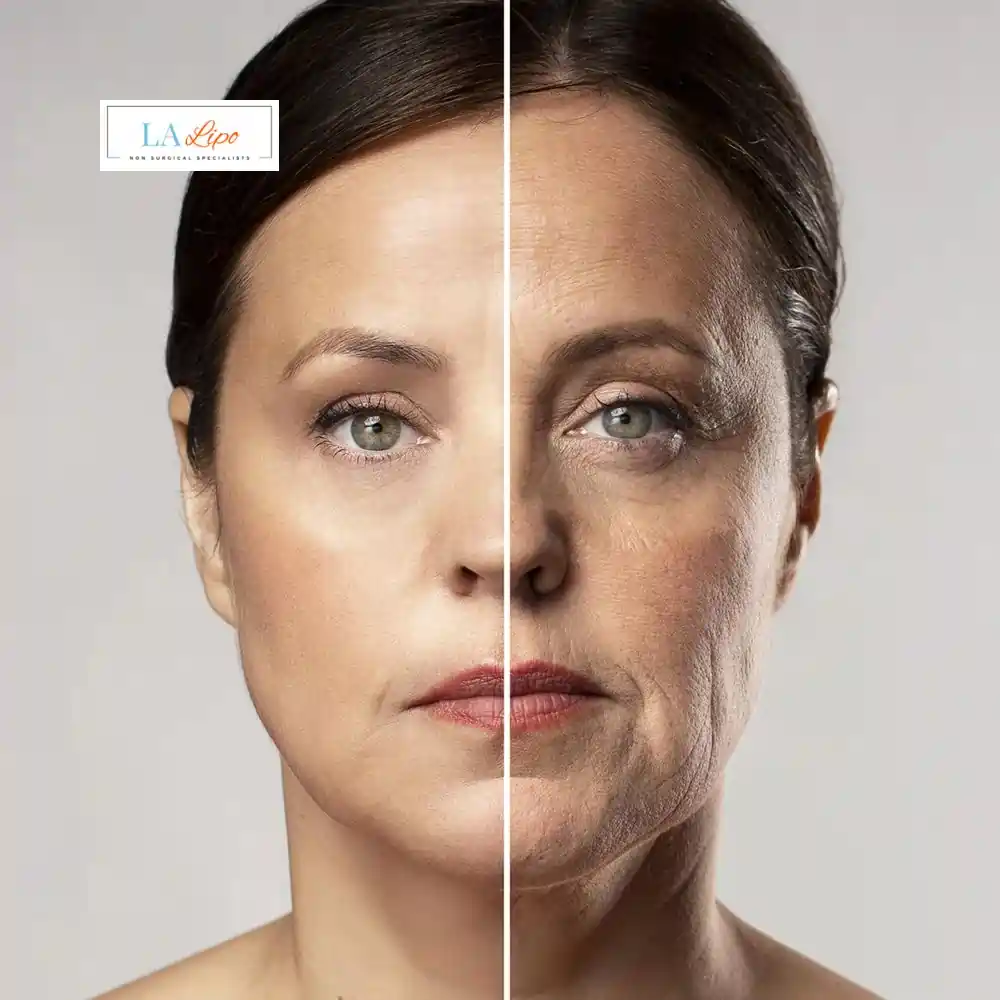 How Can You Tell If Non-Surgical Skin Tightening Is Right for You Greater London (Enfield)?