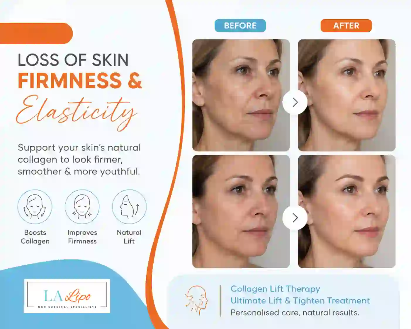 Sign #7: Loss of Skin Firmness and Elasticity Greater London (Enfield)